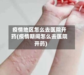 疫情地区怎么去医院开药(疫情期间怎么去医院开药)-第3张图片